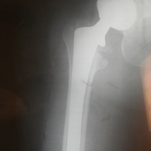 Antonio Bermudez Silverio