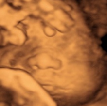 Dr. Lely Carrera Gutierrez