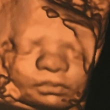 Oscar Aguirre Barrera