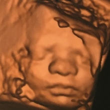 Alejandra Sanchez Teran